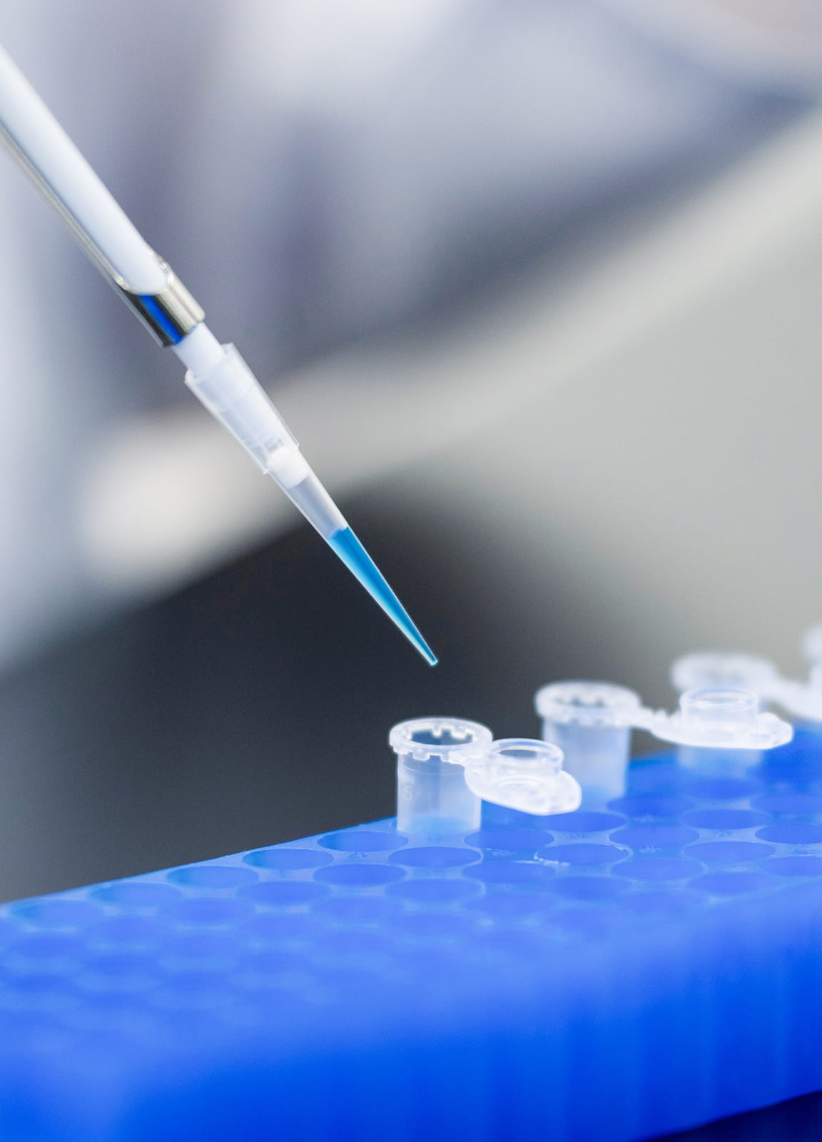 検査技師がピペットを用いて試料を扱う様子。