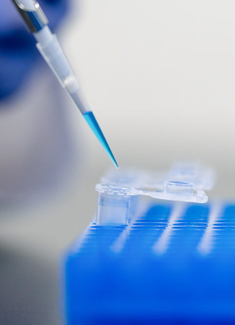 遺伝子解析用サンプルをピペットで操作する研究者の手元。